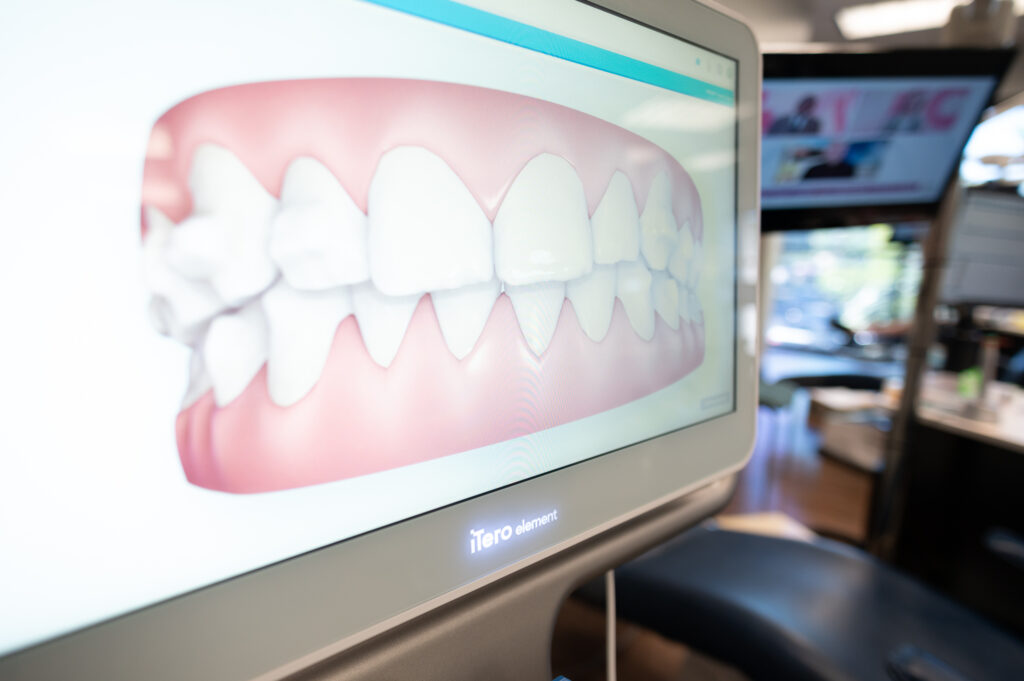 correcting teeth with orthodontic treatment